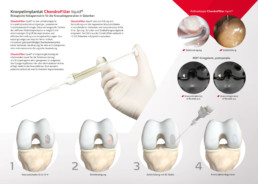 4-seitiger Informationsflyer ChondroFiller liquid, Innenseiten Layout